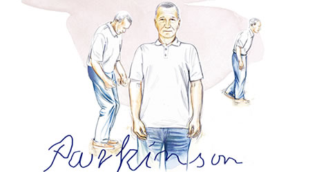 parkinson postura equistasi